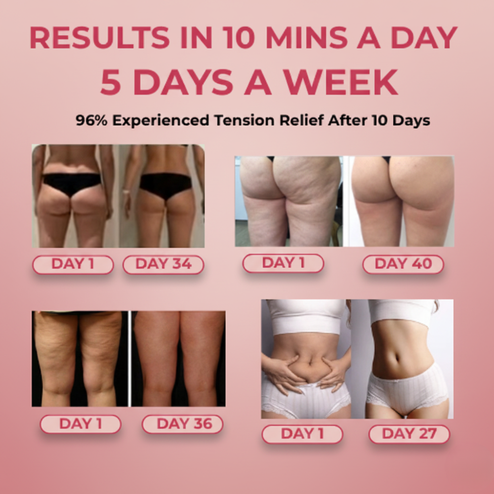 Celuvia™ Cellulite Massager