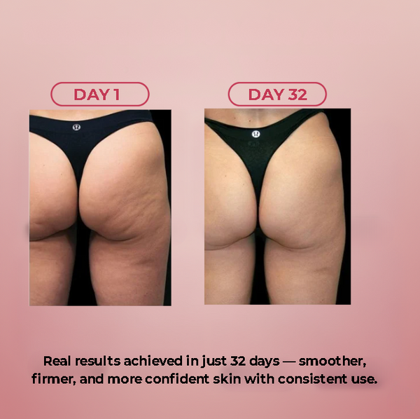 Celuvia™ Cellulite Massager